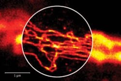 FIGURE 3. The vimentin network of a neuron is revealed by confocal (outer) and nanoscale-resolution STED (inner part) modalities. The STED image shows single filaments that appear in the confocal reference as blurs. FIGURE 3. The vimentin network of a neuron is revealed by confocal (outer) and nanoscale-resolution STED (inner part) modalities. The STED image shows single filaments that appear in the confocal reference as blurs.