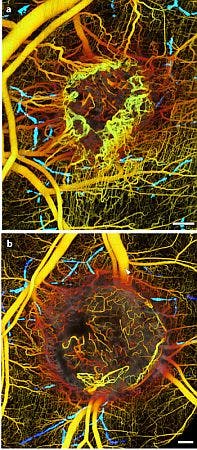 Uncovering Cancers Inner Workings 2 Web Uncovering Cancers Inner Workings 2 Web
