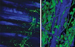 FIGURE 2. Optical slice through a Tibialis anterior muscle (left) and a 3-D reconstruction of the muscle fibers (right) from a Rosa26-YFPPdgfrb CRE mouse. A LaVision Biotec TriMScope II multiphoton microscope was used with a Zeiss 10x (0.45 NA) Plan-Apochromat lens for the optical slice and a Zeiss 20x (1.0 NA) Plan-Apochromat lens for the 3-D reconstruction. Excitation with a Coherent Vision II Ti:sapphire laser at 950 nm (GDD = 2250 fs2 for the slice; 2400 fs2 for the 3-D) was used to show the second harmonic generation (SHG) signal (blue, em = 475 ± 17.5 nm) and the YFP fluorescence (green, em = 536 ± 20 nm). The SHG signal emanates from both the muscle fibers and connective tissue (mainly collagen fibers). The YFP signal specifically highlights perivascular cells. FIGURE 2. Optical slice through a Tibialis anterior muscle (left) and a 3-D reconstruction of the muscle fibers (right) from a Rosa26-YFPPdgfrb CRE mouse. A LaVision Biotec TriMScope II multiphoton microscope was used with a Zeiss 10x (0.45 NA) Plan-Apochromat lens for the optical slice and a Zeiss 20x (1.0 NA) Plan-Apochromat lens for the 3-D reconstruction. Excitation with a Coherent Vision II Ti:sapphire laser at 950 nm (GDD = 2250 fs2 for the slice; 2400 fs2 for the 3-D) was used to show the second harmonic generation (SHG) signal (blue, em = 475 ± 17.5 nm) and the YFP fluorescence (green, em = 536 ± 20 nm). The SHG signal emanates from both the muscle fibers and connective tissue (mainly collagen fibers). The YFP signal specifically highlights perivascular cells.