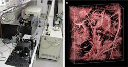 FIGURE 2. A photoacoustic imaging setup (a) that includes an Nd:YAG pump laser, plus an optical parametric oscillator (OPO) from GWU generated this view (b) of the abdominal blood vessels of a mouse. FIGURE 2. A photoacoustic imaging setup (a) that includes an Nd:YAG pump laser, plus an optical parametric oscillator (OPO) from GWU generated this view (b) of the abdominal blood vessels of a mouse.