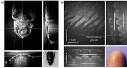 FIGURE 3. Holoscopy images show a bug ex vivo (a) and a fingertip in vivo (b) and sections through the image volume parallel to the three Cartesian axes. FIGURE 3. Holoscopy images show a bug ex vivo (a) and a fingertip in vivo (b) and sections through the image volume parallel to the three Cartesian axes.