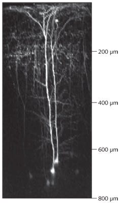 FIGURE 3. This z-axis image slice was constructed from a stack of 160 separate x-y image slices. It was recorded using 910 nm two-photon excitation and shows a live mouse cortical neuron transgenically labeled with green fluorescent protein (GFP).