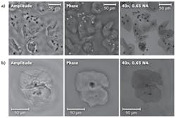 FIGURE 2. Imaging results of the lens-free multiheight holographic microscope are shown. a) Amplitude and phase images are shown of a confluent Papanicolaou test (SurePath preparation). A 40X-objective-lens microscope image is also provided for comparison. b) The amplitude, phase, and conventional microscope images of a Papanicolaou test (ThinPrep preparation) are shown. The reconstruction process does not require additional information such as spatial mask or object dimensions. FIGURE 2. Imaging results of the lens-free multiheight holographic microscope are shown. a) Amplitude and phase images are shown of a confluent Papanicolaou test (SurePath preparation). A 40X-objective-lens microscope image is also provided for comparison. b) The amplitude, phase, and conventional microscope images of a Papanicolaou test (ThinPrep preparation) are shown. The reconstruction process does not require additional information such as spatial mask or object dimensions.