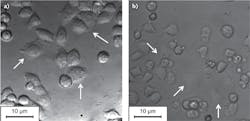 FIGURE 2. Images of a HeLa cell culture in a plastic petri dish are taken (a) using gradient field microscopy (GFM) and (b) conventional differential interference contrast (DIC) microscopy. White arrows indicate the flat cells, which show increased contrast only under GFM because of the birefringent material. FIGURE 2. Images of a HeLa cell culture in a plastic petri dish are taken (a) using gradient field microscopy (GFM) and (b) conventional differential interference contrast (DIC) microscopy. White arrows indicate the flat cells, which show increased contrast only under GFM because of the birefringent material.