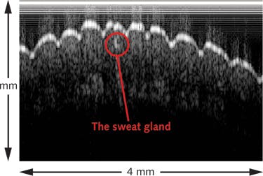 FIGURE 4. An optical coherence tomography (OCT) image of the human finger is obtained at 1 kHz by a swept-source OCT system that uses a dispersion-tuned fiber laser.