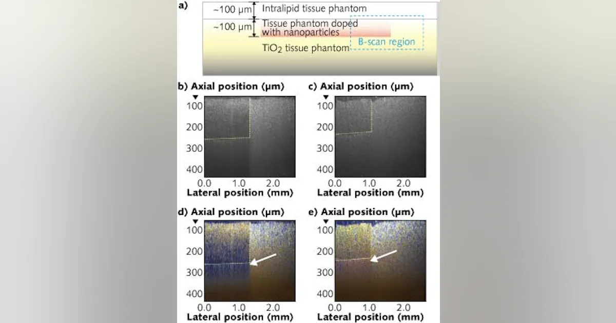 OPTICAL COHERENCE TOMOGRAPHY: Dual-window technique enhances true-color ...