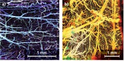 FIGURE 2. Doppler OCT imaging shows (a) microvasculature of a mouse cerebral cortex and (b) microvasculature of a rat cerebral cortex. Scale bar is 1 mm. FIGURE 2. Doppler OCT imaging shows (a) microvasculature of a mouse cerebral cortex and (b) microvasculature of a rat cerebral cortex. Scale bar is 1 mm.