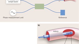 FIGURE 1. OCT imaging can provide real-time in vivo cross-sectional visualization of the internal tissue microstructure morphology by interferometrically measuring the phase delay of the injected light beam (a) using a fiber probe (b).