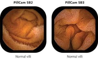 FIGURE 1. Villi in the small intestine are imaged with the PillCam SB 2 and compared to the newest generation PillCam SB 3, which has 30% improved resolution.