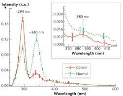 FIGURE 1. Average S3 of cancerous (solid) and normal (dash) breast tissues acquired by the selective Δλi = 40 nm: The salient difference of S3 between cancerous and normal breast tissues can be observed as two reverses of the peak intensities at ~294 and ~340 nm, and a tiny peak is evident at 385 nm for the cancerous tissue. FIGURE 1. Average S3 of cancerous (solid) and normal (dash) breast tissues acquired by the selective Δλi = 40 nm: The salient difference of S3 between cancerous and normal breast tissues can be observed as two reverses of the peak intensities at ~294 and ~340 nm, and a tiny peak is evident at 385 nm for the cancerous tissue.