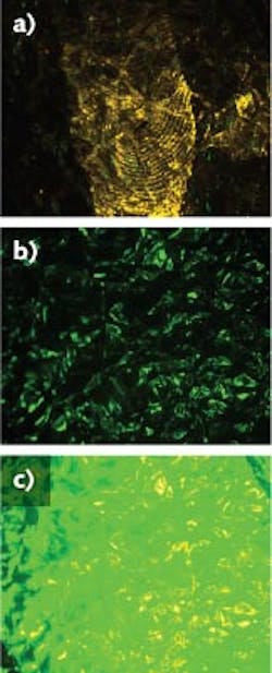 High fluorescence intensity is a major advantage of using laser light rather than a filtered lamp “alternative light source” (ALS). This is useful for examining any surface, but particularly those that are highly contoured. a) On aluminum foil exposed to Rhodamine 6G, laser illumination allows the camera aperture to be greatly reduced to obtain sufficient depth of focus for this crinkled surface. b) The same fingerprint could not be seen using an ALS, c) even when the exposure time was extended. High fluorescence intensity is a major advantage of using laser light rather than a filtered lamp “alternative light source” (ALS). This is useful for examining any surface, but particularly those that are highly contoured. a) On aluminum foil exposed to Rhodamine 6G, laser illumination allows the camera aperture to be greatly reduced to obtain sufficient depth of focus for this crinkled surface. b) The same fingerprint could not be seen using an ALS, c) even when the exposure time was extended.