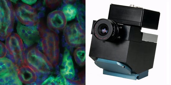 FIGURE 1. Headwall Photonics&apos; hyperspectral imaging device (right) reveals spatial and spectroscopic features of tissues, such as these cancerous kidney cells (left).