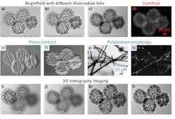 FIGURE 2. Brightfield (a-c), darkfield (d), phase-contrast (e, f), polarization (g, h), and 3D (i-l) tomographic images using the proposed LCD-based setups. We used a 10X, 0.25 objective in this demonstration. FIGURE 2. Brightfield (a-c), darkfield (d), phase-contrast (e, f), polarization (g, h), and 3D (i-l) tomographic images using the proposed LCD-based setups. We used a 10X, 0.25 objective in this demonstration.