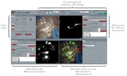 FIGURE 2. FLARE provides real-time data acquisition and data analysis of four independent video streams, and presents this information through a streamlined graphical user interface. For this example, the 700 and 800 nm NIR fluorescence channels are pseudo-colored green and red (respectively) in the merged image. FIGURE 2. FLARE provides real-time data acquisition and data analysis of four independent video streams, and presents this information through a streamlined graphical user interface. For this example, the 700 and 800 nm NIR fluorescence channels are pseudo-colored green and red (respectively) in the merged image.