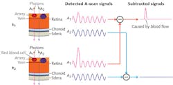 FIGURE 1. How OCTA works: As moving blood cells pass through vessels, they generate changes in OCT signals. Based on this concept, a blood flow signal can be extracted by subtracting the OCT signals from the same location but at different time points (red path). The OCT signals will be different at these locations, while OCT signals from surrounding retinal tissues will remain steady (blue path). FIGURE 1. How OCTA works: As moving blood cells pass through vessels, they generate changes in OCT signals. Based on this concept, a blood flow signal can be extracted by subtracting the OCT signals from the same location but at different time points (red path). The OCT signals will be different at these locations, while OCT signals from surrounding retinal tissues will remain steady (blue path).