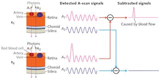 FIGURE 1. How OCTA works: As moving blood cells pass through vessels, they generate changes in OCT signals. Based on this concept, a blood flow signal can be extracted by subtracting the OCT signals from the same location but at different time points (red path). The OCT signals will be different at these locations, while OCT signals from surrounding retinal tissues will remain steady (blue path).