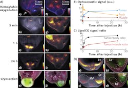 FIGURE 2. Kinetics of LipoICG75 accumulation in 4T1 and HT29 tumor models imaged with MSOT. (A) (a) Transverse MSOT image of a 4T1 tumor before injection of LipoICG (gray scale) overlaid with signal from oxy- (red) and deoxygenated (blue) Hgb arrows indicate the main blood vessels supplying the tumor); (b-d) overlay of MSOT LipoICG75 signal (hot scale) on a background image (gray scale) at 5 min, 1 h, and 24 h post-injection; (e) color image of a corresponding cryosection overlaid with ICG fluorescence signal (green scale); and (f-j) similar experiments performed on an HT29 tumor. (B) Maximum LipoICG75 signal intensity in the tumor (black line), whole body without tumor (gray line), and in back muscles (dashed black line). (C) Maximum LipoICG75 signal intensity ratio between the tumor and the whole body (gray line) and back muscles (black line). (D) (a) MSOT image of the liver (Lv) of a tumor-bearing animal overlaid with LipoICG75 signal (hot scale); (b) ICG fluorescence (green scale) overlaid on a corresponding cryosection; and (c-d) Similar layout for the images of the same animal acquired at the kidney (Kd) and spleen (Sp) region. FIGURE 2. Kinetics of LipoICG75 accumulation in 4T1 and HT29 tumor models imaged with MSOT. (A) (a) Transverse MSOT image of a 4T1 tumor before injection of LipoICG (gray scale) overlaid with signal from oxy- (red) and deoxygenated (blue) Hgb arrows indicate the main blood vessels supplying the tumor); (b-d) overlay of MSOT LipoICG75 signal (hot scale) on a background image (gray scale) at 5 min, 1 h, and 24 h post-injection; (e) color image of a corresponding cryosection overlaid with ICG fluorescence signal (green scale); and (f-j) similar experiments performed on an HT29 tumor. (B) Maximum LipoICG75 signal intensity in the tumor (black line), whole body without tumor (gray line), and in back muscles (dashed black line). (C) Maximum LipoICG75 signal intensity ratio between the tumor and the whole body (gray line) and back muscles (black line). (D) (a) MSOT image of the liver (Lv) of a tumor-bearing animal overlaid with LipoICG75 signal (hot scale); (b) ICG fluorescence (green scale) overlaid on a corresponding cryosection; and (c-d) Similar layout for the images of the same animal acquired at the kidney (Kd) and spleen (Sp) region.
