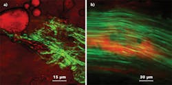FIGURE 3. Examples of multimodal imaging utilizing a supercontinuum-based wavelength extension unit pumped by a Spectra-Physics Mai Tai Ti:sapphire laser: coherent anti-Stokes Raman scattering (CARS, red) and second harmonic generation (SHG, green) microscopy of tissue from a) bovine muscle and b) rodent tail. Vibrations probed by CARS were the C-H2 stretch modes at ~2850 cm-1; SHG was generated at 800 nm. FIGURE 3. Examples of multimodal imaging utilizing a supercontinuum-based wavelength extension unit pumped by a Spectra-Physics Mai Tai Ti:sapphire laser: coherent anti-Stokes Raman scattering (CARS, red) and second harmonic generation (SHG, green) microscopy of tissue from a) bovine muscle and b) rodent tail. Vibrations probed by CARS were the C-H2 stretch modes at ~2850 cm-1; SHG was generated at 800 nm.