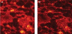 FIGURE 2. An OCT image of rat adipose tissue (a) is compared to an ISAM reconstruction from the same data (b). The field of view is 500 × 500 μm. FIGURE 2. An OCT image of rat adipose tissue (a) is compared to an ISAM reconstruction from the same data (b). The field of view is 500 × 500 μm.