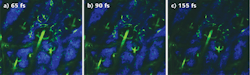 FIGURE 2. Shorter pulses improve image quality in two-photon excited fluorescence (TPEF) and second harmonic generation (SHG) microscopy as shown in these images of green fluorescence protein (TPEF, in green) and collagen (SHG, in blue) in a mouse ear (in vivo image, 500 × 500 μm). The pulsewidth at the sample was changed between 65 fs (a) and 155 fs (c) using a Spectra-Physics Mai Tai DeepSee laser. All other parameters were kept constant, including average power (20 mW at 870 nm) and detector sensitivity. FIGURE 2. Shorter pulses improve image quality in two-photon excited fluorescence (TPEF) and second harmonic generation (SHG) microscopy as shown in these images of green fluorescence protein (TPEF, in green) and collagen (SHG, in blue) in a mouse ear (in vivo image, 500 × 500 μm). The pulsewidth at the sample was changed between 65 fs (a) and 155 fs (c) using a Spectra-Physics Mai Tai DeepSee laser. All other parameters were kept constant, including average power (20 mW at 870 nm) and detector sensitivity.
