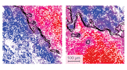Two examples of NIVI images show the technique&apos;s capability for finding tumors and their boundaries. The pixelation in the images comes from undersampling, rather than the optical resolution of the system. The blue color-coded regions have been classified as normal, the red as abnormal (tumor), and the pink as indeterminate. An algorithm automatically computes a black-line boundary based on the NIVI data.