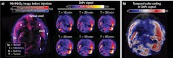 FIGURE 1. (a) In vivo background-corrected maximum intensity projection (MIP) images of transverse slices through mouse pre-injection and, within the first hour after injection, show gradual probe accumulation within the tumor site and various organs over time. (b) Time-resolved color coding of the MSOT signal, within the first hour after injection, demonstrates peak probe localization at the tumor site and various organs at 1 h post-injection. FIGURE 1. (a) In vivo background-corrected maximum intensity projection (MIP) images of transverse slices through mouse pre-injection and, within the first hour after injection, show gradual probe accumulation within the tumor site and various organs over time. (b) Time-resolved color coding of the MSOT signal, within the first hour after injection, demonstrates peak probe localization at the tumor site and various organs at 1 h post-injection.