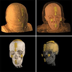 FIGURE 3. A digital hologram of the Rhind mummy allows viewers to peel off the outer wrapping and observe interior details of the face and skull.
