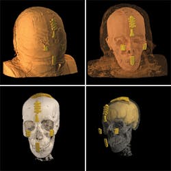 FIGURE 3. A digital hologram of the Rhind mummy allows viewers to peel off the outer wrapping and observe interior details of the face and skull. FIGURE 3. A digital hologram of the Rhind mummy allows viewers to peel off the outer wrapping and observe interior details of the face and skull.
