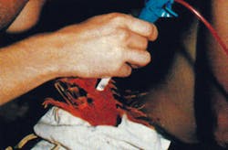 FIGURE 5. Portable spectrometers let lizard researchers measure the color of lizard skin in research on their ecology in Puerto Rico. FIGURE 5. Portable spectrometers let lizard researchers measure the color of lizard skin in research on their ecology in Puerto Rico.