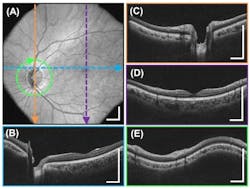 Octmit Fig2 Octmit Fig2
