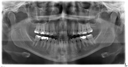 TDI CCDs are still the sensors of choice for demanding applications ...