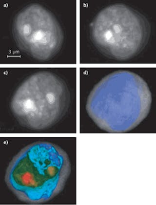 FIGURE 1. Two-dimensional (2D) maximum-intensity projections in different orientations are created from a 3D reconstruction of a squamous-cancer cell (a&ndash;c). The figure also shows the same cell from the perspective in (c), whole and cropped, where coloring and opacity have been adjusted to enhance cell features. In (d) and (e), cytoplasm is in translucent gray, the nuclear wall is in opaque blue, and the nucleoplasm is rendered in a green to red gradient, with nucleoli in opaque red.