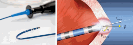 FIGURE 3. A fiber-optic intra-aortic force sensing catheter probe enables real-time monitoring of the force exerted against the heart wall by the catheter.