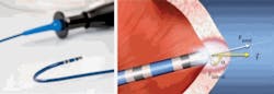 FIGURE 3. A fiber-optic intra-aortic force sensing catheter probe enables real-time monitoring of the force exerted against the heart wall by the catheter.