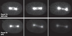 FIGURE 3. Stills from time-lapse recording of tubulin GFP embryos at metaphase, early anaphase, and late anaphase imaged using a multiphoton microscope (Panel A) or SFC (Panel B). Multiphoton images were acquired every five seconds and SFC images were acquired every second. The SFC provided compatible resolution and viability while giving superior speed over the multiphoton method.