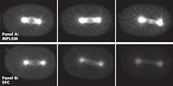 FIGURE 3. Stills from time-lapse recording of tubulin GFP embryos at metaphase, early anaphase, and late anaphase imaged using a multiphoton microscope (Panel A) or SFC (Panel B). Multiphoton images were acquired every five seconds and SFC images were acquired every second. The SFC provided compatible resolution and viability while giving superior speed over the multiphoton method. FIGURE 3. Stills from time-lapse recording of tubulin GFP embryos at metaphase, early anaphase, and late anaphase imaged using a multiphoton microscope (Panel A) or SFC (Panel B). Multiphoton images were acquired every five seconds and SFC images were acquired every second. The SFC provided compatible resolution and viability while giving superior speed over the multiphoton method.