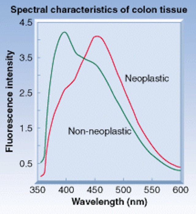Spectral signatures were created by the virtual Biopsy System from data obtained from the tissue being tested. Using this information, the system renders a diagnostic recommendation in the form of an icon&mdash;red for &apos;suspect&apos; (neoplastic), green for &apos;nonsuspect&apos; (non-neoplastic).