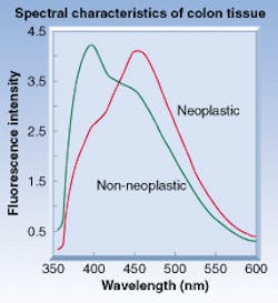 Spectral signatures were created by the virtual Biopsy System from data obtained from the tissue being tested. Using this information, the system renders a diagnostic recommendation in the form of an icon—red for 'suspect' (neoplastic), green for 'nonsuspect' (non-neoplastic). Spectral signatures were created by the virtual Biopsy System from data obtained from the tissue being tested. Using this information, the system renders a diagnostic recommendation in the form of an icon—red for 'suspect' (neoplastic), green for 'nonsuspect' (non-neoplastic).