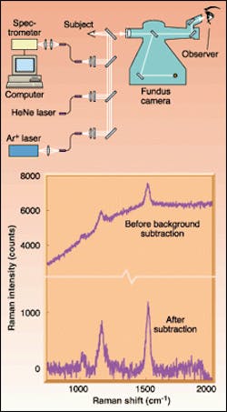 Argon-ion laser and spectrometer are mated to a fundus camera to measure carotenoid levels in the living human macula via Raman scattering (top). Results on a volunteer show two Raman-scattering peaks (bottom). Comparing these peaks to the height of a carbon peak pins down the subject's macular carotenoid concentration at about 400 nm, a typical value for a human subject. Argon-ion laser and spectrometer are mated to a fundus camera to measure carotenoid levels in the living human macula via Raman scattering (top). Results on a volunteer show two Raman-scattering peaks (bottom). Comparing these peaks to the height of a carbon peak pins down the subject's macular carotenoid concentration at about 400 nm, a typical value for a human subject.