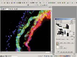 Th 0512lfwolympus Th 0512lfwolympus