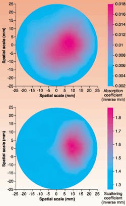 Reconstructed absorption (top) and scattering (bottom) images were obtained at the joint plane around the index-finger joint of a healthy volunteer. The pinkish region corresponds to the finger; the bluish background corresponds to the background material into which the finger is inserted. Reconstructed absorption (top) and scattering (bottom) images were obtained at the joint plane around the index-finger joint of a healthy volunteer. The pinkish region corresponds to the finger; the bluish background corresponds to the background material into which the finger is inserted.