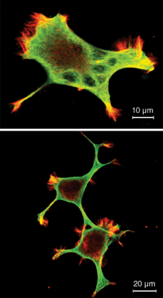 FIGURE 2. A neuron-like cell fixed and stained for actin (red) and microtubules (green) was imaged by fluorescence excited by 488-nm and 543-nm selected from the supercontinuum. The scale bar is 10 &micro;m. A two-photon-excitation fluorescence image of two cells was recorded using IR light (bottom). The scale bar is 20 &micro;m.