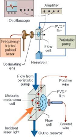 In a photoacoustic melanoma-detection system, beam energy from a 450 nm frequency-tripled Nd:YAG laser enters a flow cell in 11 to12 mJ pulses with a repetition rate of 10 Hz. Laser light is taken directly from the polarizer and spatially oriented by a cylindrical lens. The resulting ultrasound wave is detected through a piezoelectric detector; if a melanoma cell is present, there is a spike in the resulting readout. In a photoacoustic melanoma-detection system, beam energy from a 450 nm frequency-tripled Nd:YAG laser enters a flow cell in 11 to12 mJ pulses with a repetition rate of 10 Hz. Laser light is taken directly from the polarizer and spatially oriented by a cylindrical lens. The resulting ultrasound wave is detected through a piezoelectric detector; if a melanoma cell is present, there is a spike in the resulting readout.