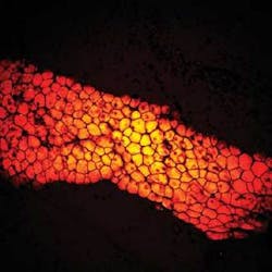 When imaged with CARS microscopy, white adipose tissue on a mouse thigh muscle produces a strong signal because adipose cells are rich in fats. The contrast is derived from the CH2 symmetric-stretching vibration, which is abundant in fats and lipids. When imaged with CARS microscopy, white adipose tissue on a mouse thigh muscle produces a strong signal because adipose cells are rich in fats. The contrast is derived from the CH2 symmetric-stretching vibration, which is abundant in fats and lipids.