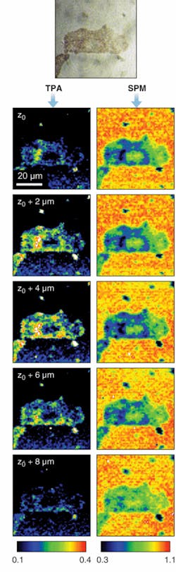 FIGURE 5. A brightfield image of a fixed B16 melanoma cell (top) is compared with TPA and SPM images. FIGURE 5. A brightfield image of a fixed B16 melanoma cell (top) is compared with TPA and SPM images.