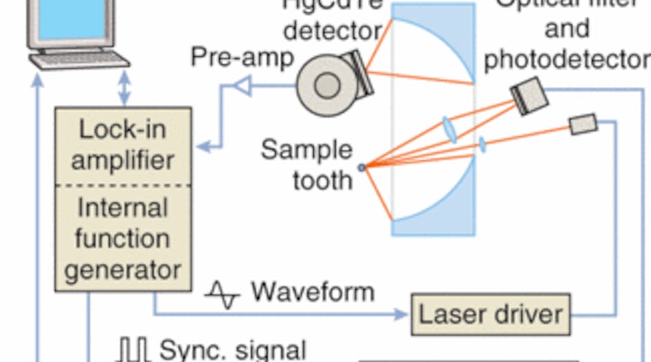 Nonintrusive, noncontact frequency-domain photothermal radiometry and frequency-domain luminescence rely on 659 and 830 nm diode-laser sources and a mercury cadmium telluride (HgCdTe) photodetector to assess the pits and fissures on the surfaces of human teeth.