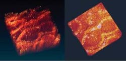 FIGURE 3. Volume renderings of human melanoma are imaged by two-photon absorption (left) and two-photon fluorescence (right). Note the difference in the depth resolution, reflecting reabsorption of fluorescence by the melanoma plus the background autofluorescence. The TPA image is 266 &times; 266 &times; 105 &micro;m in volume.