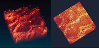 FIGURE 3. Volume renderings of human melanoma are imaged by two-photon absorption (left) and two-photon fluorescence (right). Note the difference in the depth resolution, reflecting reabsorption of fluorescence by the melanoma plus the background autofluorescence. The TPA image is 266 &times; 266 &times; 105 &micro;m in volume.