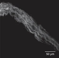 FIGURE 3. For this third-harmonic-generation image of collagen extracted from the trachea of a mouse, the SPOPO provided radiation at a wavelength of 1.54 µm to maximize the harmonic-generation process. The resolution of the resultant image is comparable to the fluorescence images obtained using 3PLSM. FIGURE 3. For this third-harmonic-generation image of collagen extracted from the trachea of a mouse, the SPOPO provided radiation at a wavelength of 1.54 µm to maximize the harmonic-generation process. The resolution of the resultant image is comparable to the fluorescence images obtained using 3PLSM.