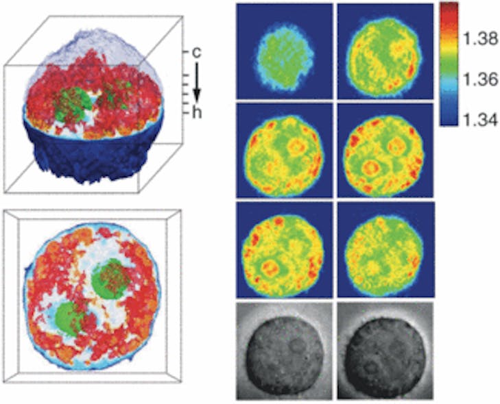FIGURE 1. Images of a cervical-cancer cell were taken using the new imaging technique. Two 3-D images of the cell are shown at left; 2-D slices are seen at right. The green structures represent the nucleus, which surrounds the nucleolus (not visible in these images). The red areas are unidentified cell organelles.